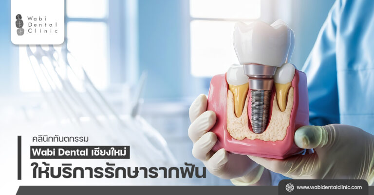 Wabi Dental คลินิกทันตกรรม เชียงใหม่ ให้บริการรักษารากฟัน