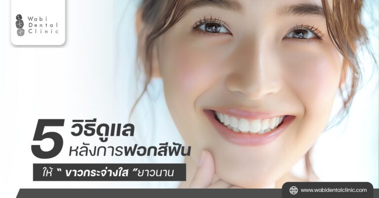 5 วิธีดูแลหลังฟอกสีฟัน ให้ขาวกระจ่างใสยาวนาน