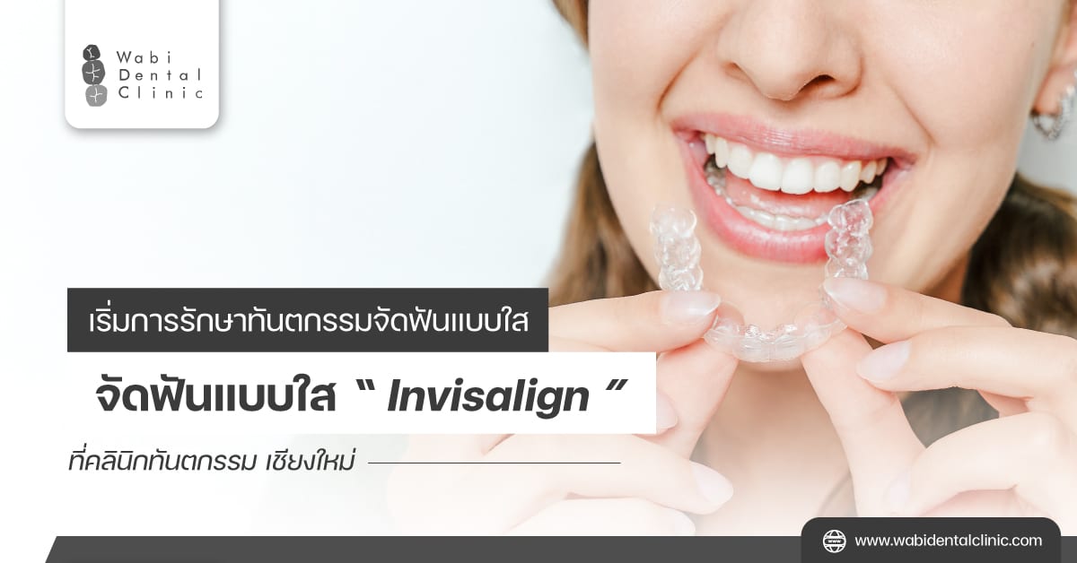 เริ่มการรักษาทันตกรรมจัดฟันแบบใส (Invisalign) ที่คลินิกทันตกรรม เชียงใหม่