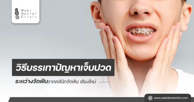 วิธีบรรเทาปัญหาเจ็บปวดระหว่างจัดฟันจากคลินิกจัดฟัน เชียงใหม่