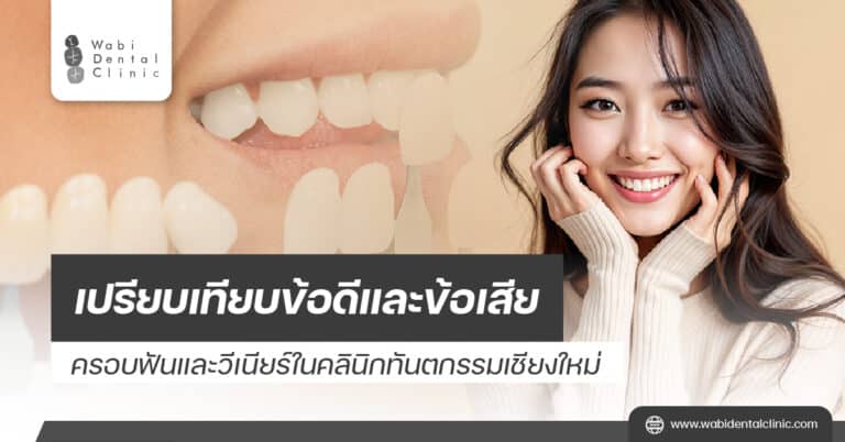 เปรียบเทียบข้อดีและข้อเสียครอบฟันและวีเนียร์ใน คลินิกทันตกรรมเชียงใหม่