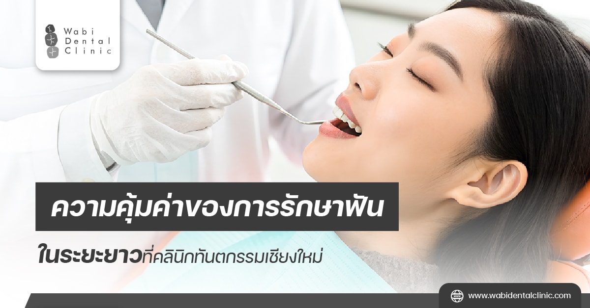 ความคุ้มค่าของการรักษาฟันในระยะยาวที่ คลินิกทันตกรรมเชียงใหม่