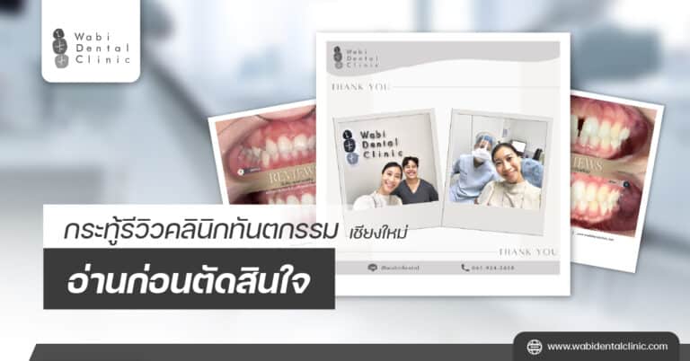 กระทู้รีวิวคลินิกทันตกรรม เชียงใหม่ อ่านก่อนตัดสินใจ