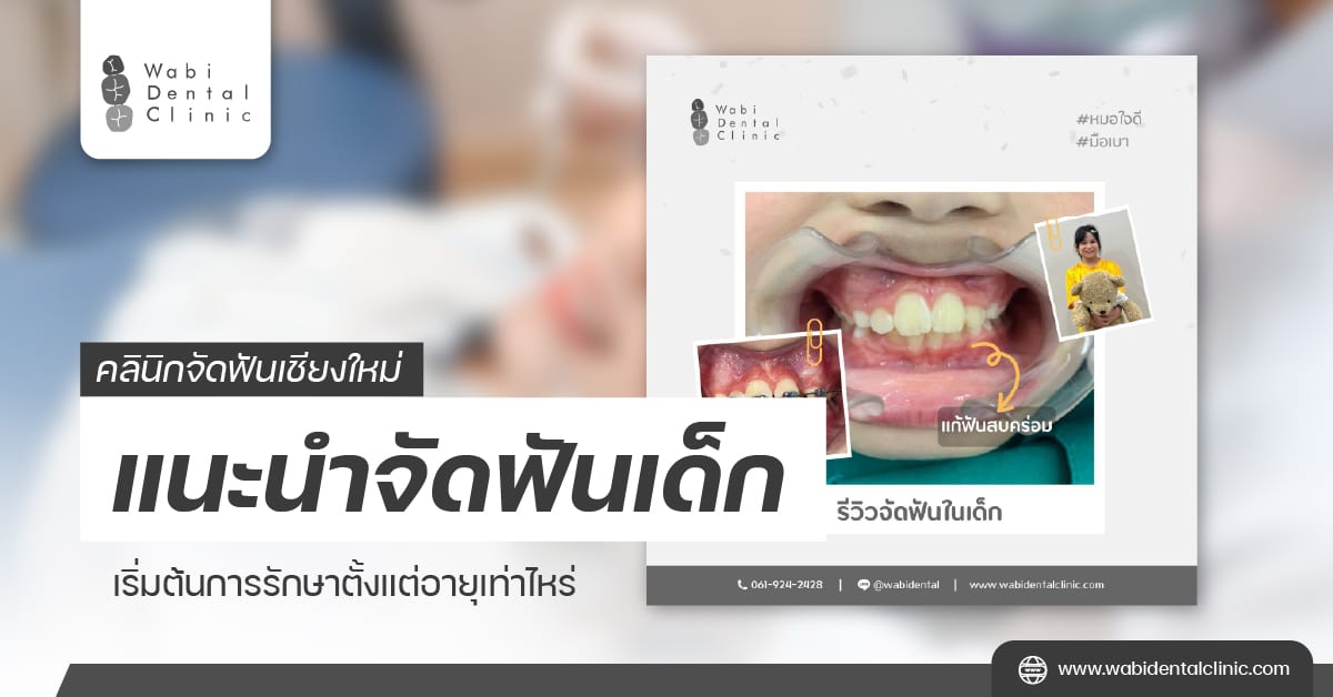 คลินิกจัดฟันเชียงใหม่ แนะนำจัดฟันเด็ก เริ่มต้นการรักษาตั้งแต่อายุเท่าไหร่